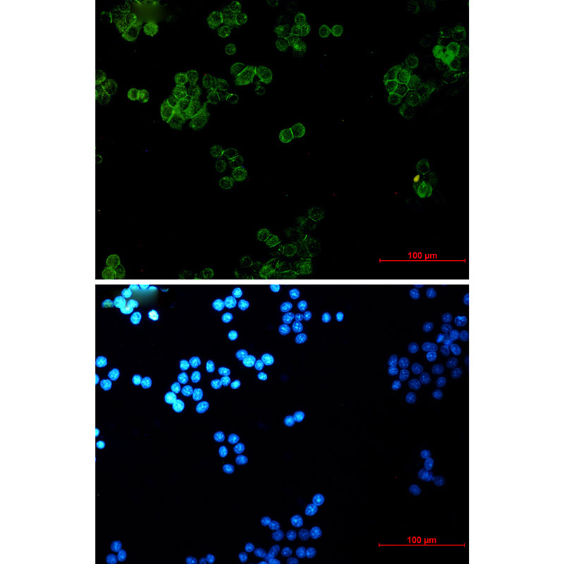 Rabbit monoclonal antibody