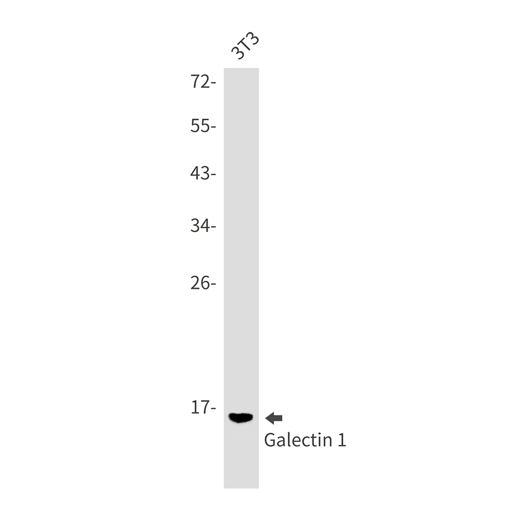 Rabbit monoclonal antibody