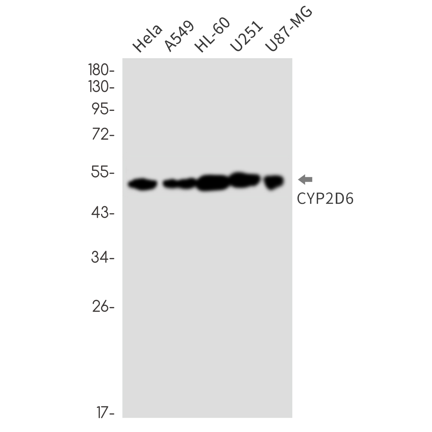 Rabbit monoclonal antibody