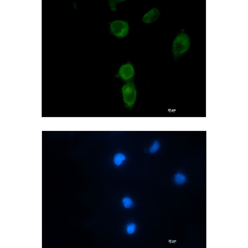 Rabbit monoclonal antibody