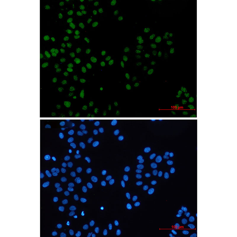 Rabbit monoclonal antibody