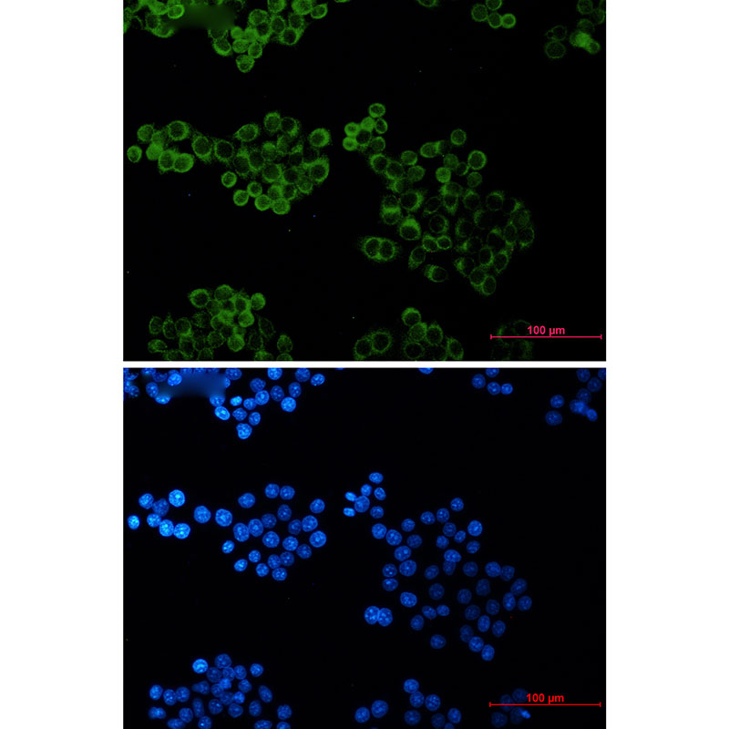Rabbit monoclonal antibody
