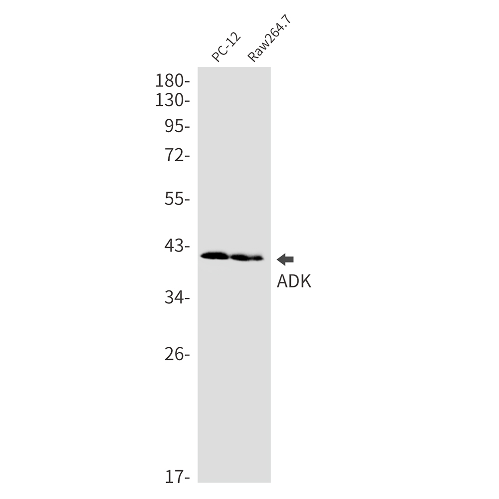 Rabbit monoclonal antibody