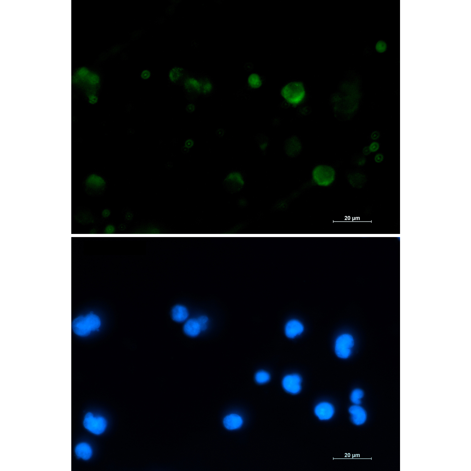 Rabbit monoclonal antibody