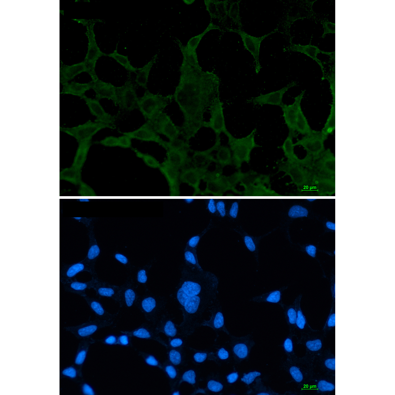 Rabbit monoclonal antibody