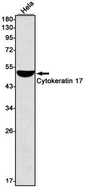 Rabbit monoclonal antibody