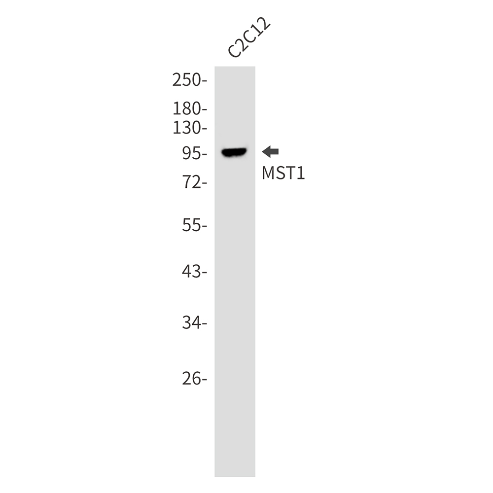 Rabbit monoclonal antibody