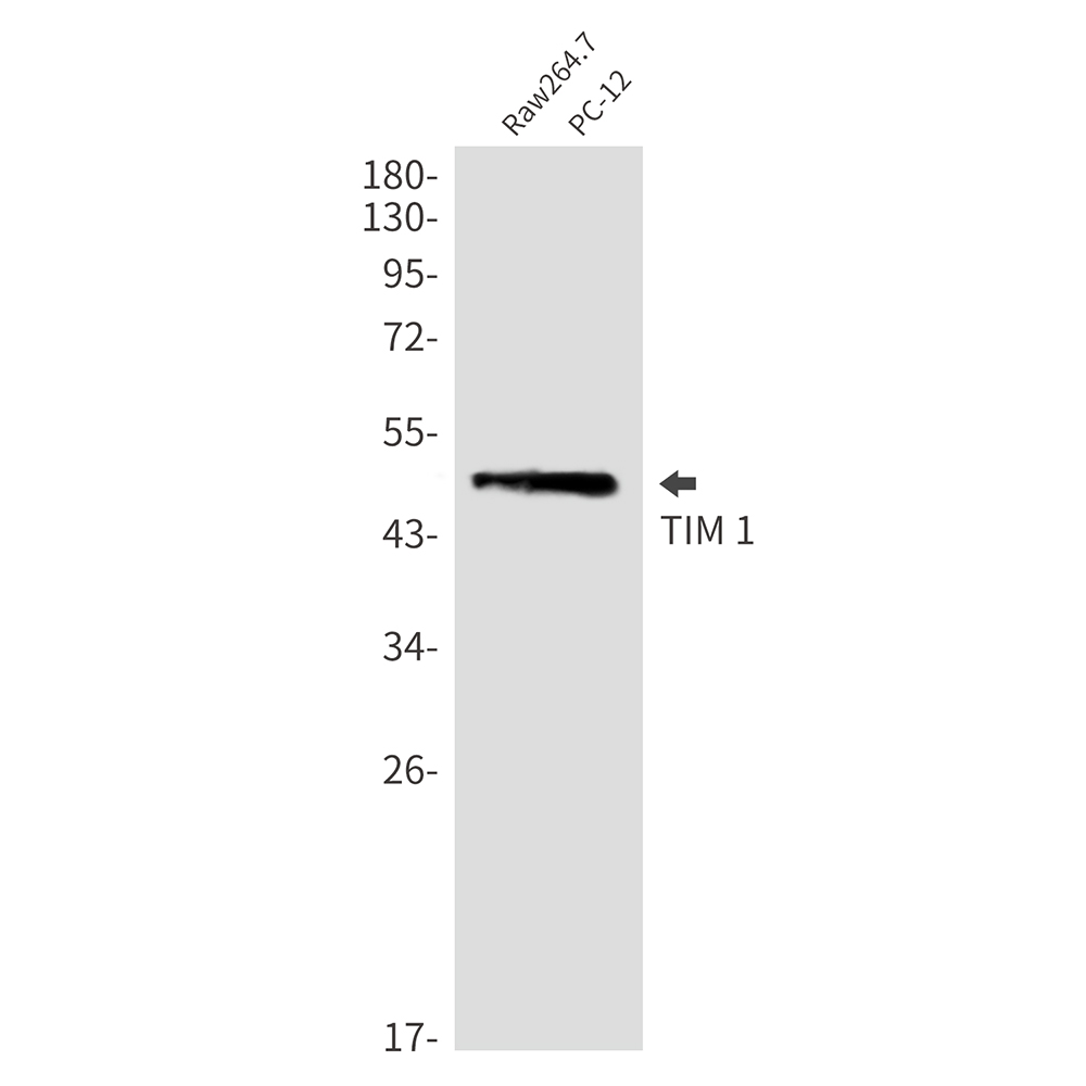 Rabbit monoclonal antibody