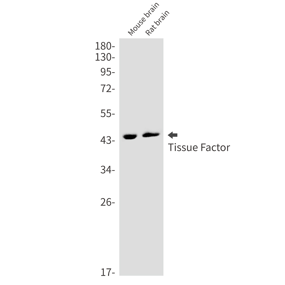 Rabbit monoclonal antibody