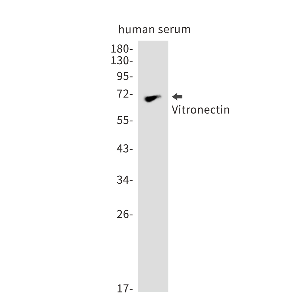 Rabbit monoclonal antibody