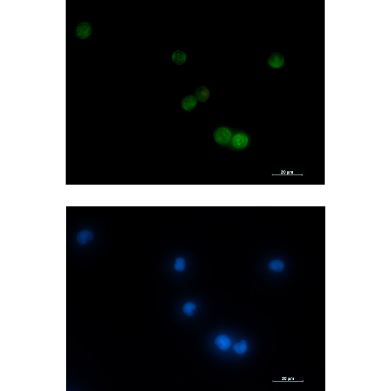 Rabbit monoclonal antibody