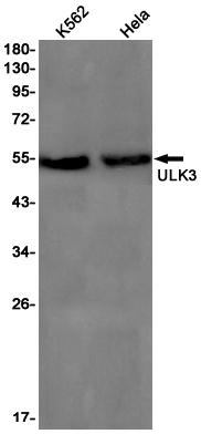 Rabbit monoclonal antibody