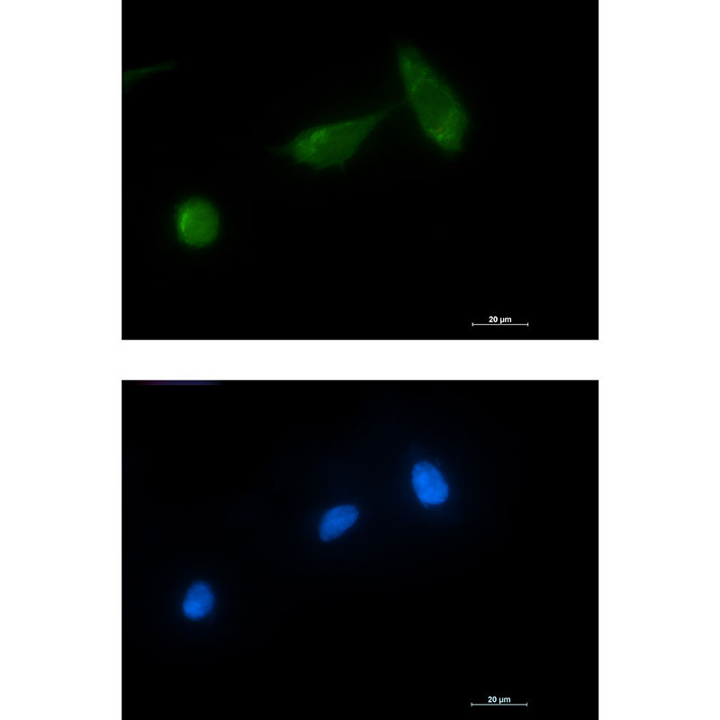 Rabbit monoclonal antibody