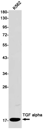 Rabbit monoclonal antibody