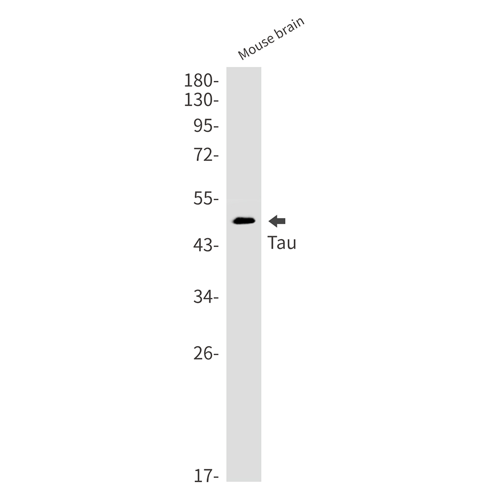 Rabbit monoclonal antibody