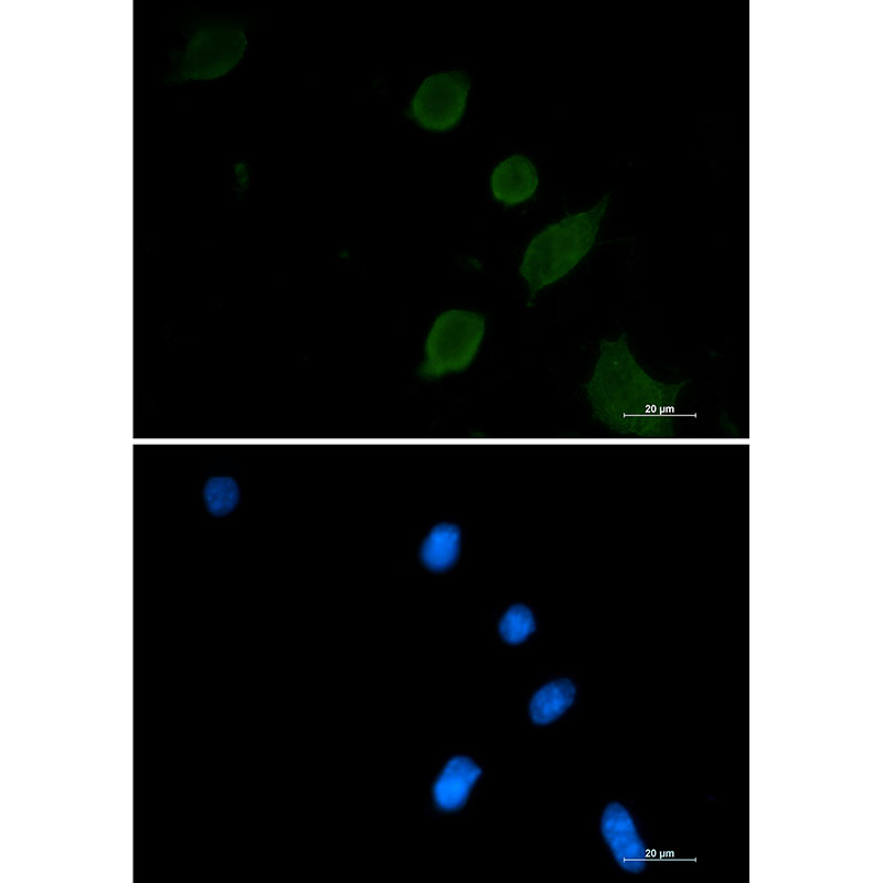 Rabbit monoclonal antibody