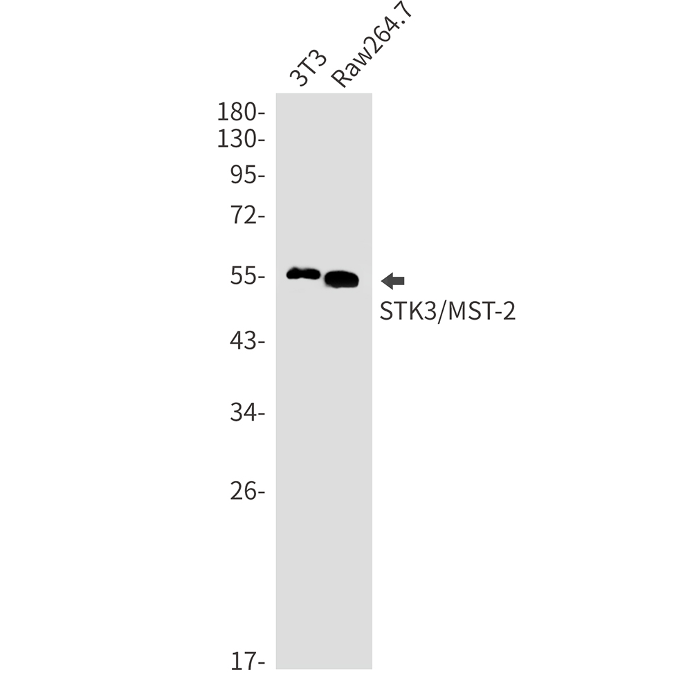 Rabbit monoclonal antibody