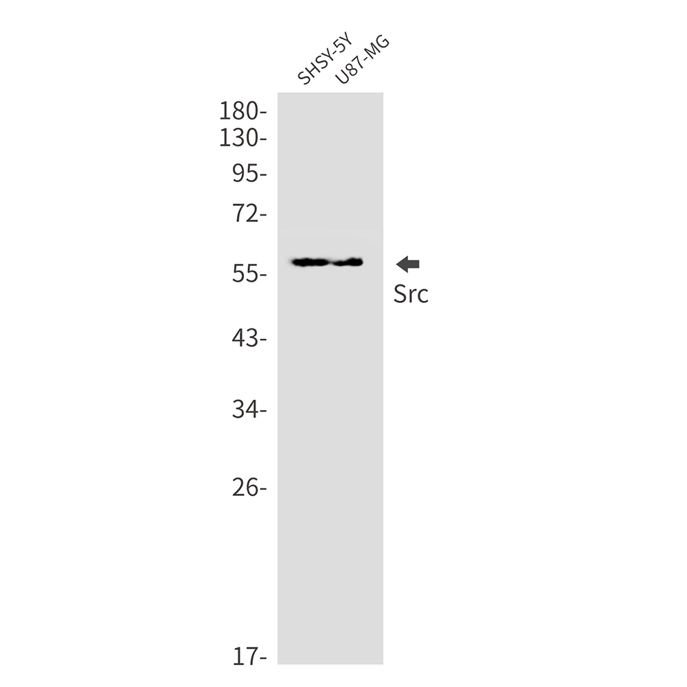Rabbit monoclonal antibody