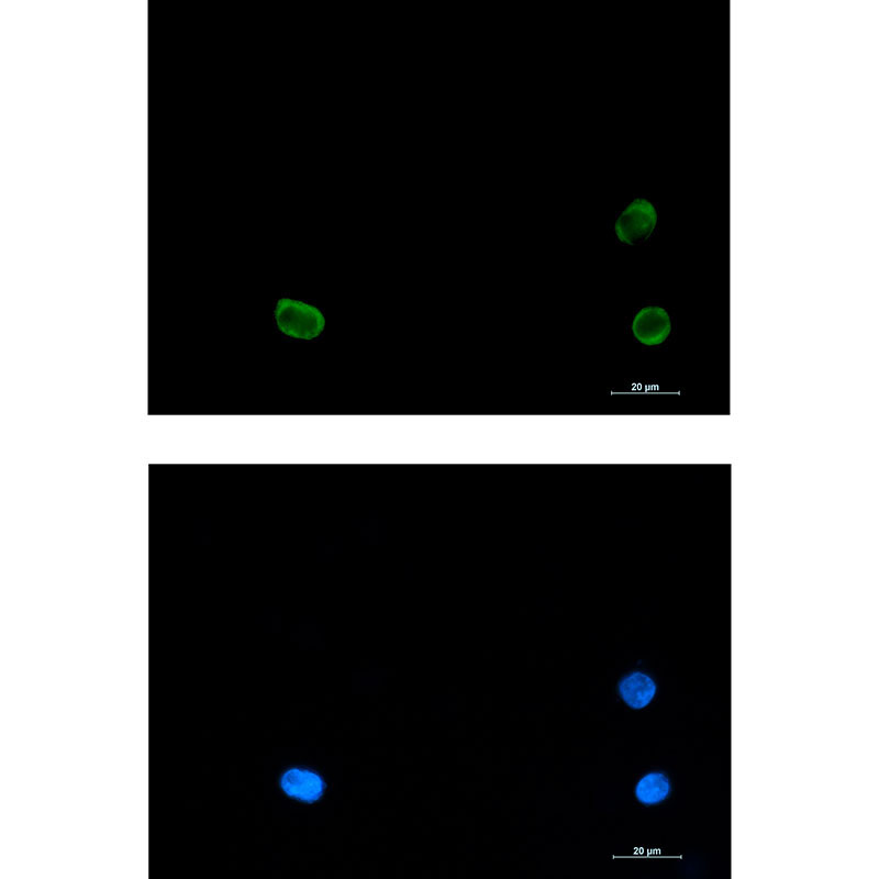 Rabbit monoclonal antibody