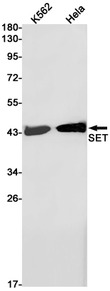 Rabbit monoclonal antibody