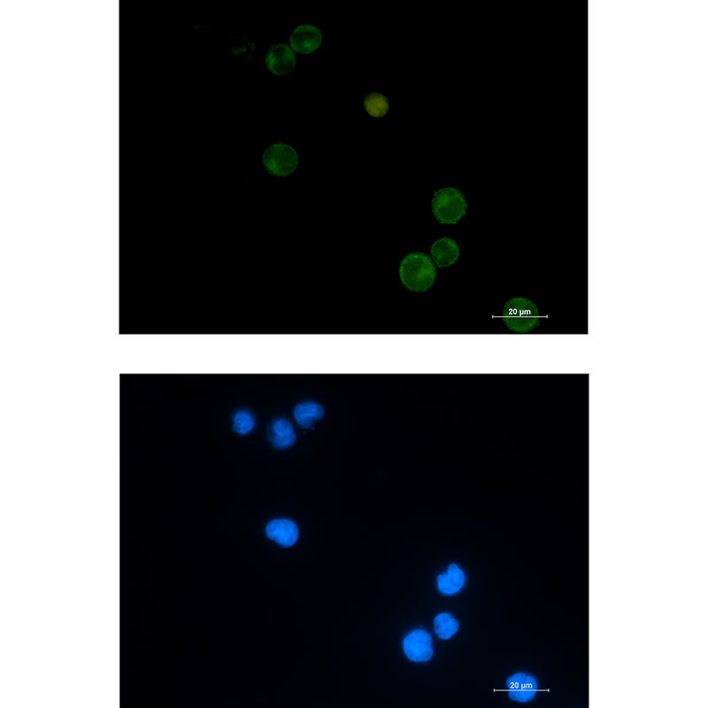 Rabbit monoclonal antibody