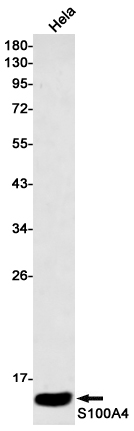 Rabbit monoclonal antibody