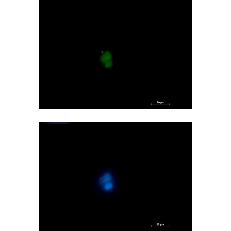 Rabbit monoclonal antibody