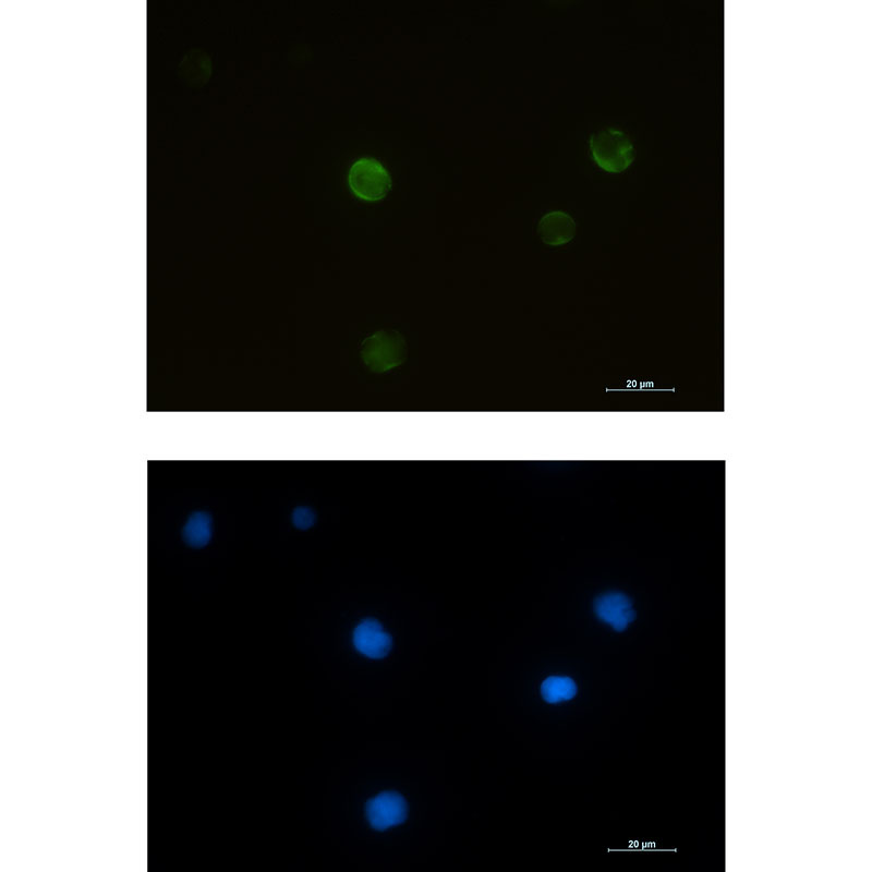 Rabbit monoclonal antibody