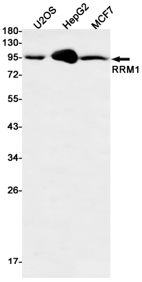 Rabbit monoclonal antibody