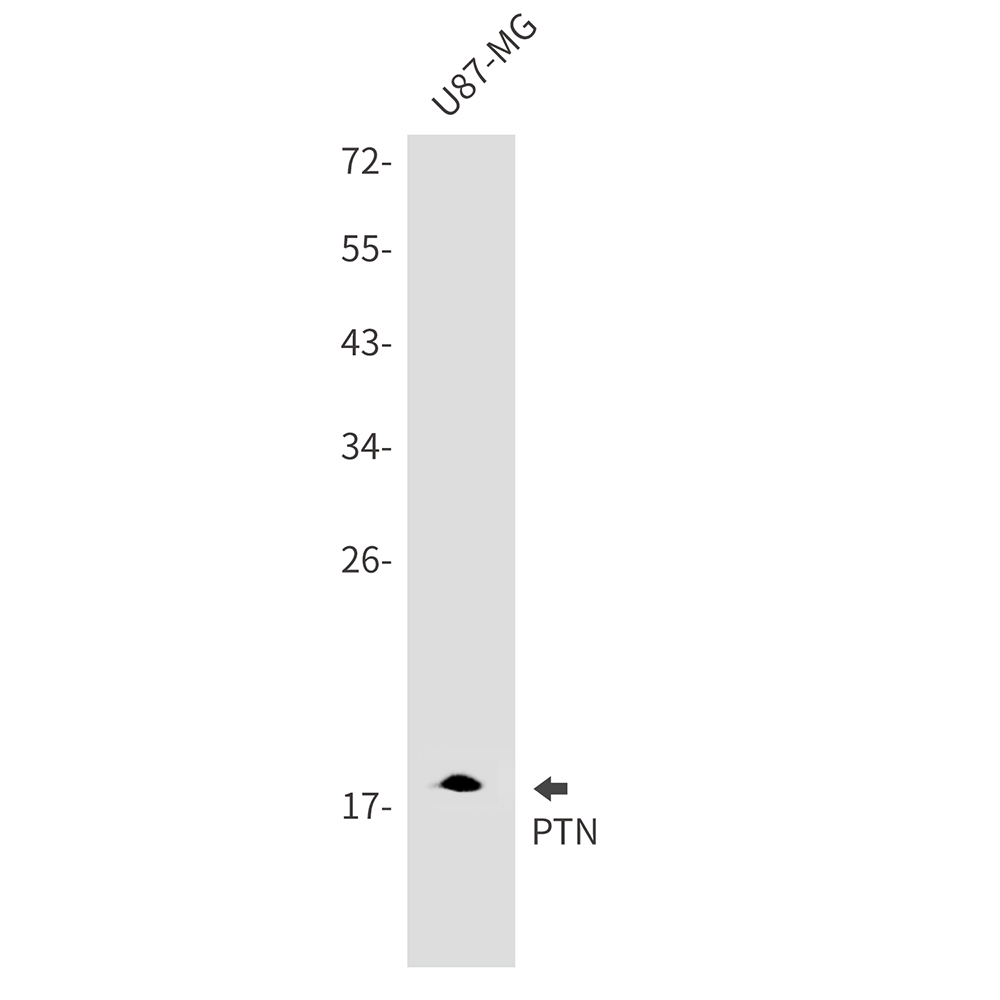 Rabbit monoclonal antibody