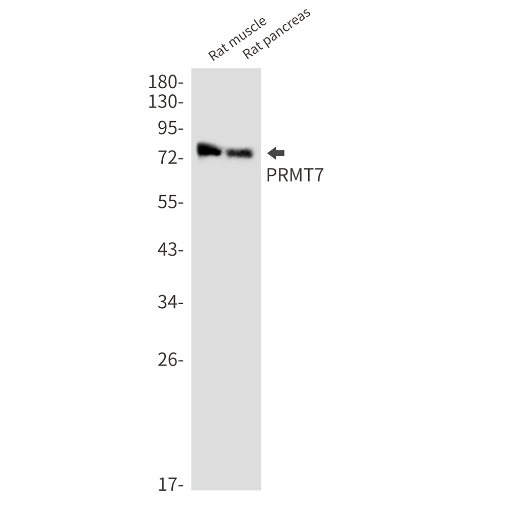 Rabbit monoclonal antibody