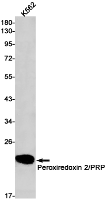 Rabbit monoclonal antibody