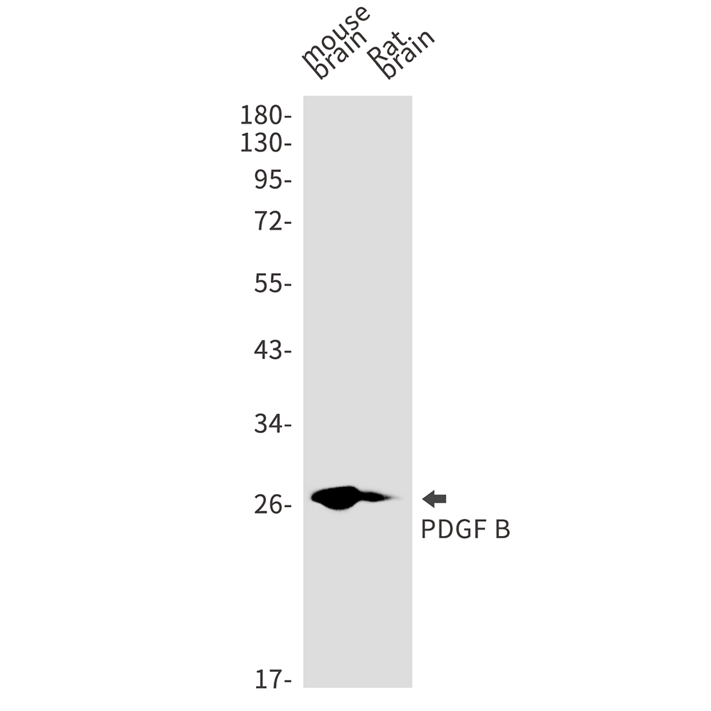 Rabbit monoclonal antibody