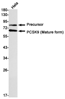Rabbit monoclonal antibody