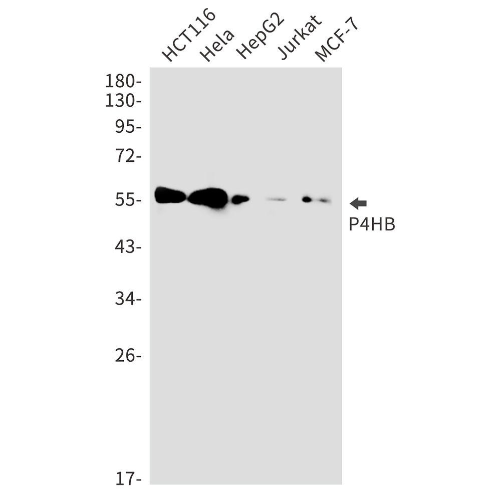 Rabbit monoclonal antibody