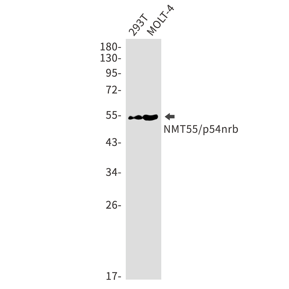 Rabbit monoclonal antibody