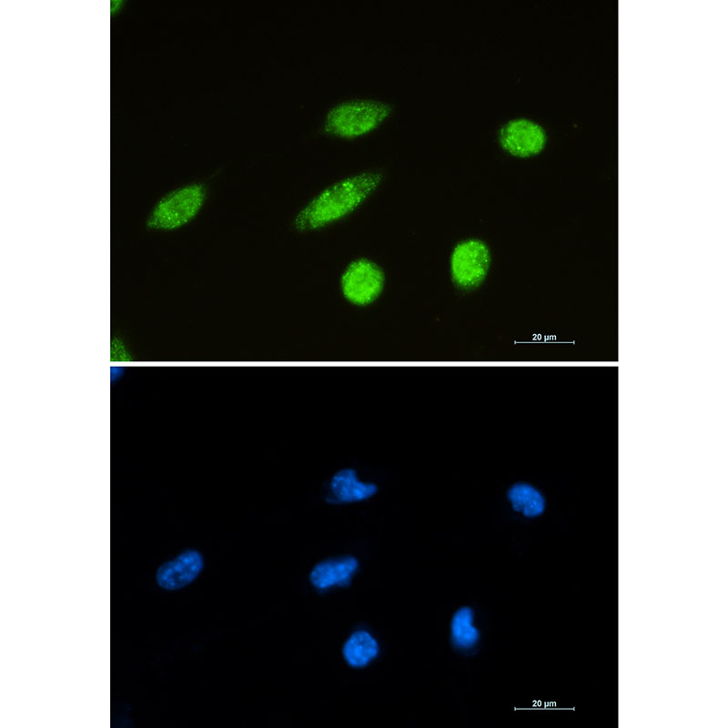 Rabbit monoclonal antibody