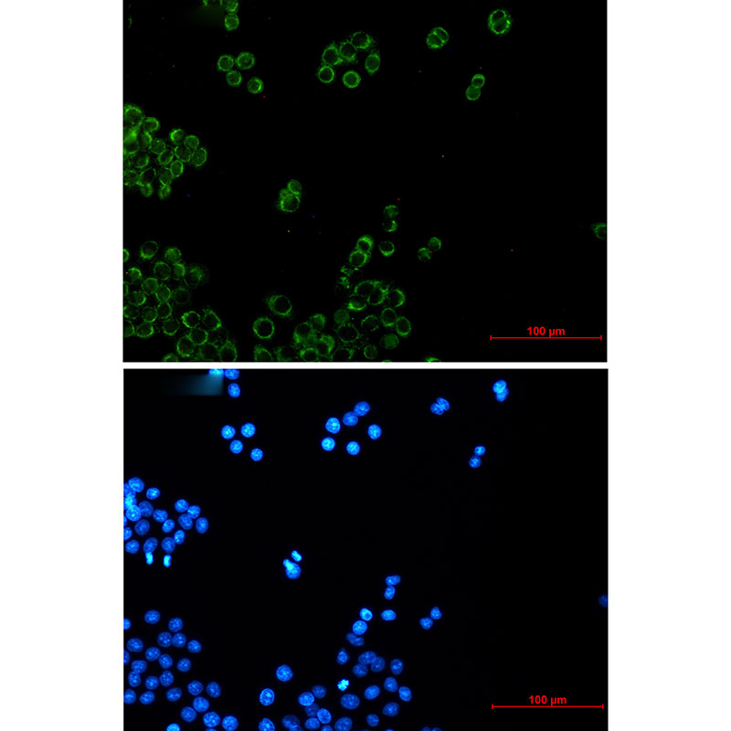 Rabbit monoclonal antibody