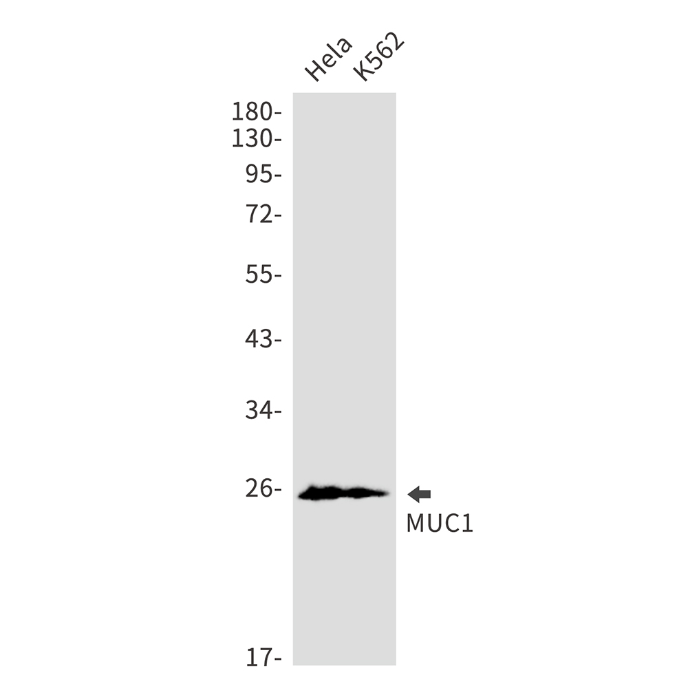Rabbit monoclonal antibody