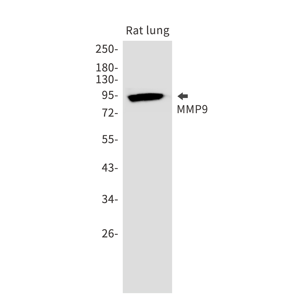 Rabbit monoclonal antibody