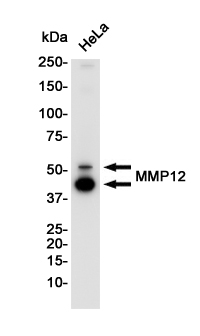 Rabbit monoclonal antibody