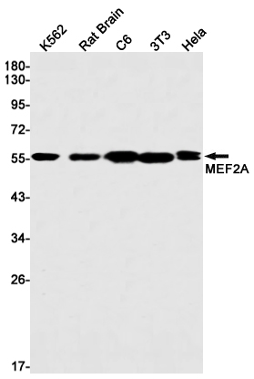 Rabbit monoclonal antibody
