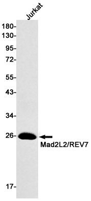 Rabbit monoclonal antibody