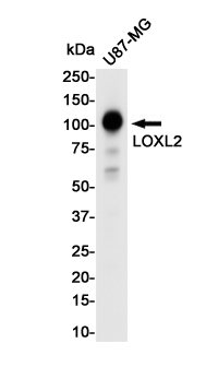 Rabbit monoclonal antibody