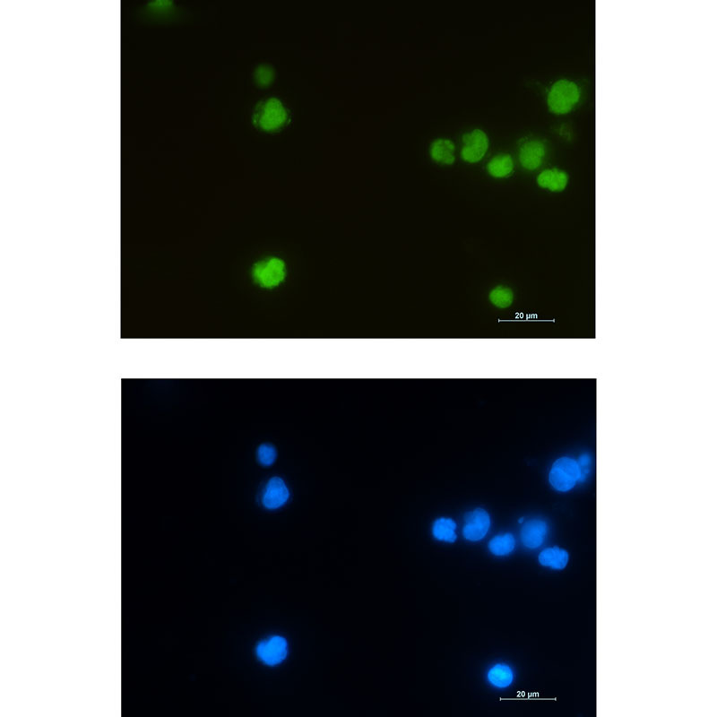 Rabbit monoclonal antibody