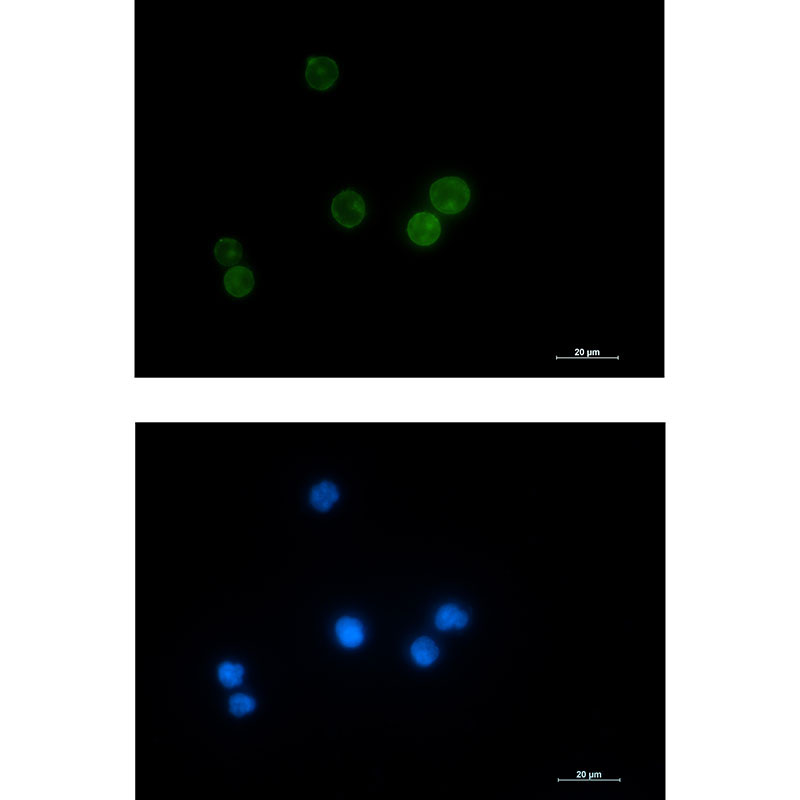 Rabbit monoclonal antibody