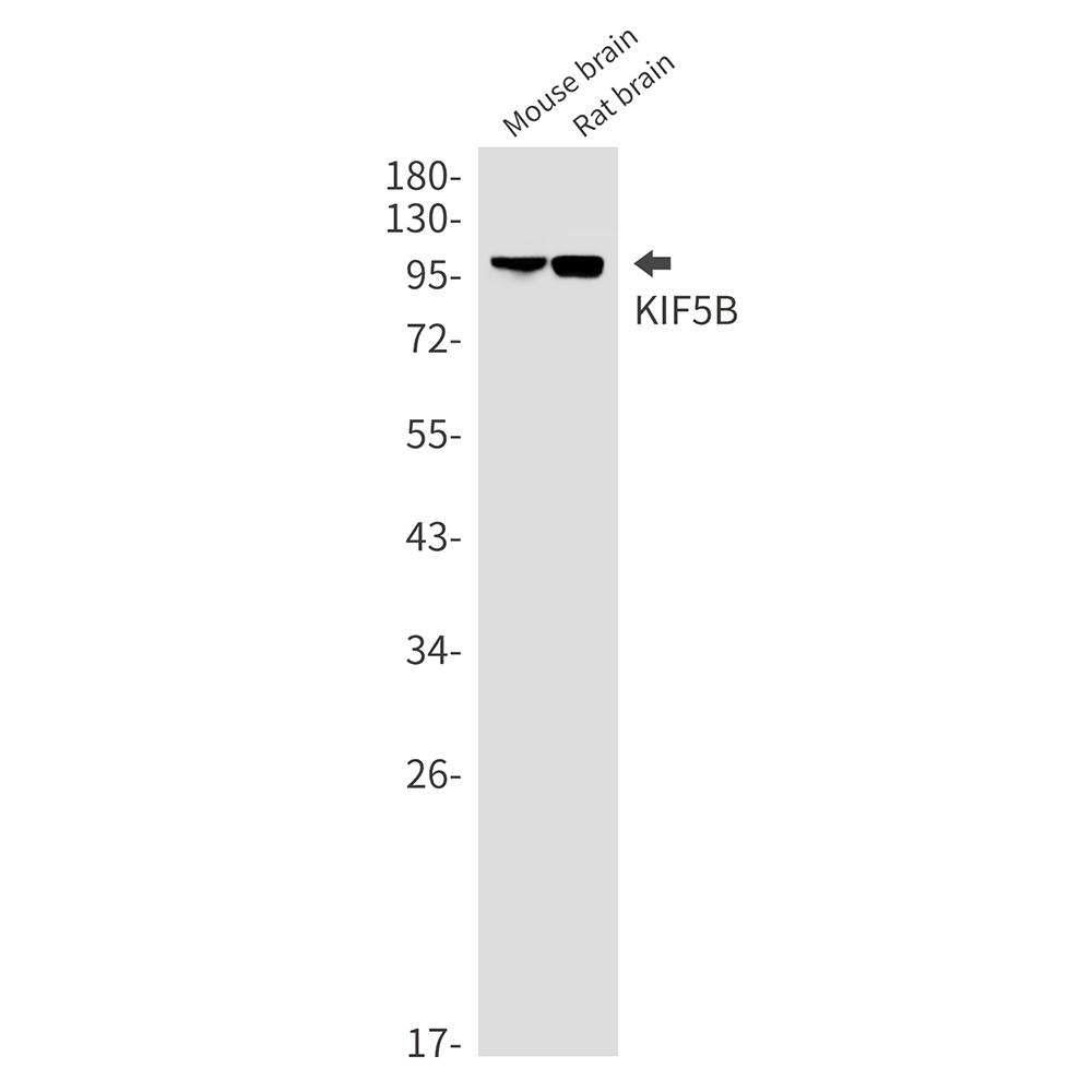 Rabbit monoclonal antibody