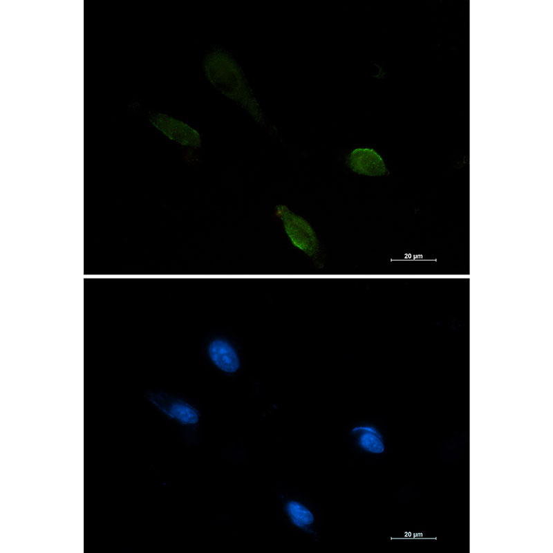 Rabbit monoclonal antibody