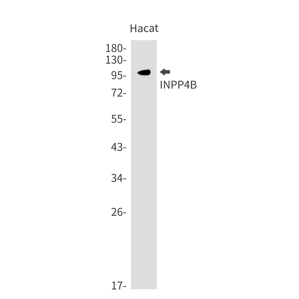 Rabbit monoclonal antibody
