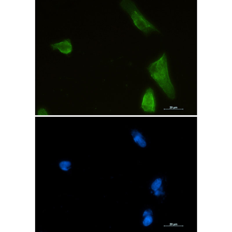 Rabbit monoclonal antibody